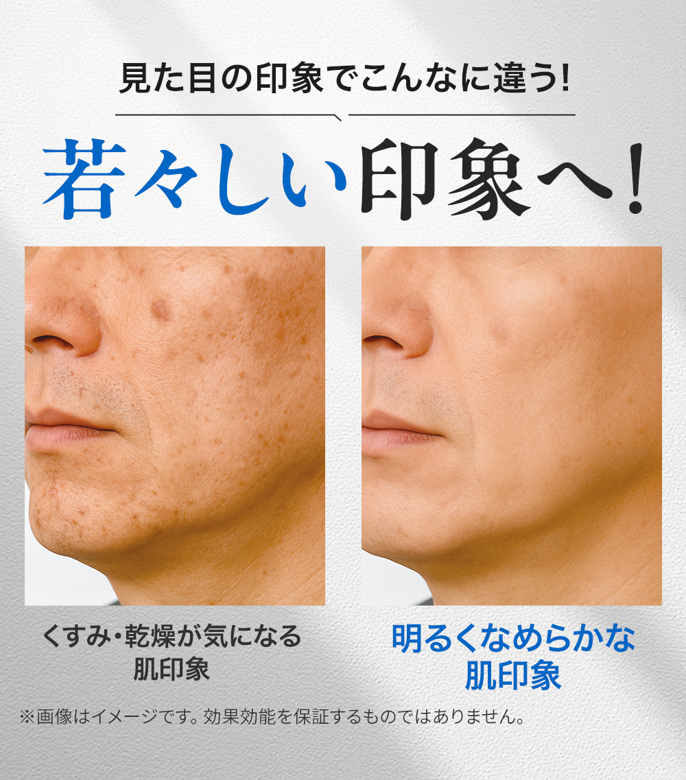 見た目の印象でこんなに違う!若々しい印象へ