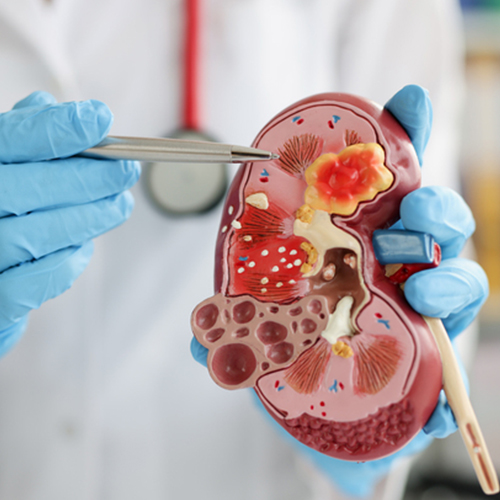 腎機能の低下による口臭