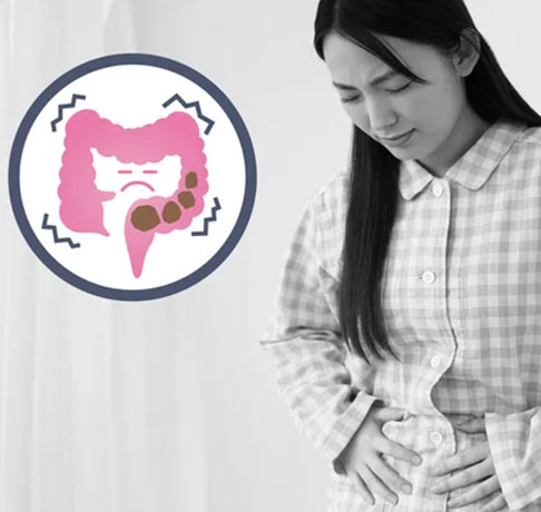 腸内環境はなぜ大事？便通や免疫、メンタルヘルスまで様々な影響を知ろう